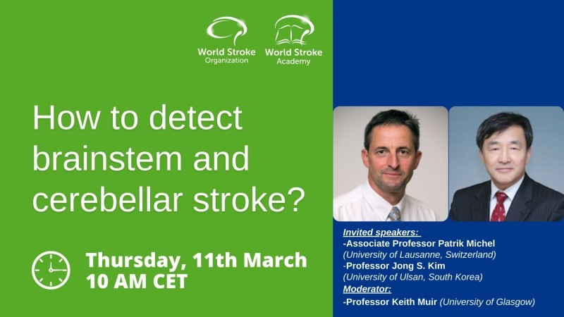 How to detect brain stem and cerebellar stroke?