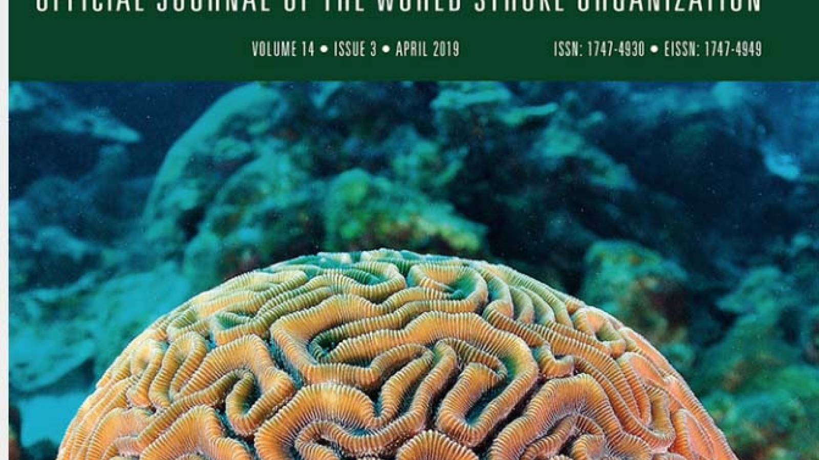 Cognition in stroke rehabilitation and recovery research: Consensus-based core recommendations from the second Stroke Recovery and Rehabilitation Roundtable with Dr Michael O’Sullivan